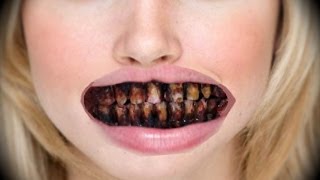 ELLE A BESOIN D UN DENTISTE - Terrorift