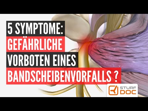 Herniated disc - These 5 symptoms will warn you of it!