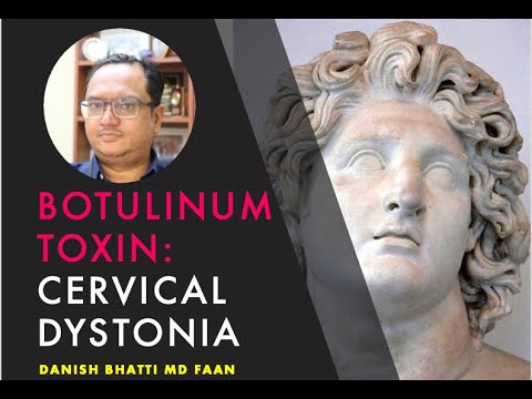 Botulinum toxin for Cervical Dystonia April 2024