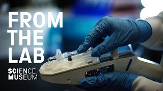 Healing burns victims with spray-on skin