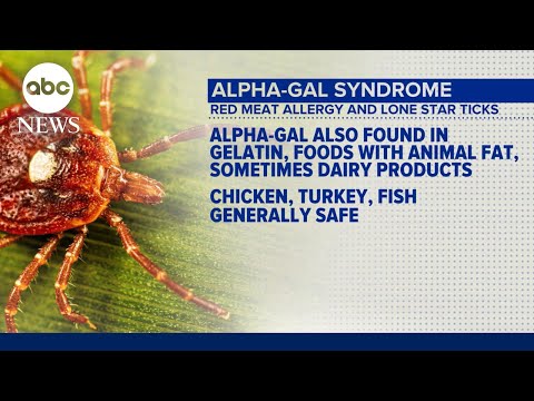 Ticks rising across the US that can cause red meat allergy