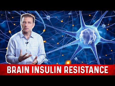 Adrenal Fatigue Is Cortisol Responsible for Your Diabetes Dr Berg