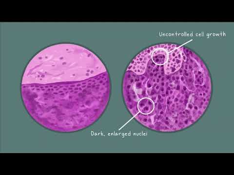 Menacing Mutations: Examining the Role of the RAS Oncogene in Cancer Development