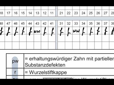 Coverdenture-Prothesen oder Deckprothesen - HKP abrechnen 2/4