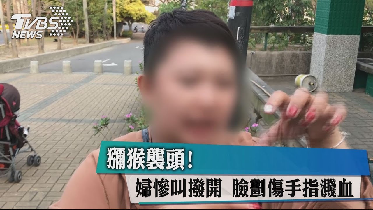 獼猴襲頭!慘叫撥開 臉劃傷、手指濺血