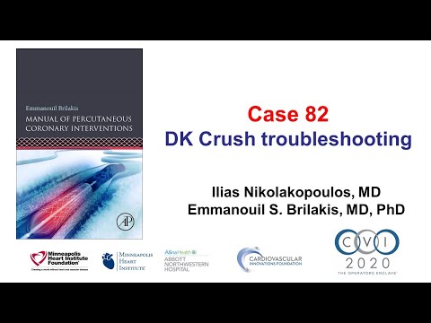 Case 82: PCI Manual - DK crush troubleshooting
