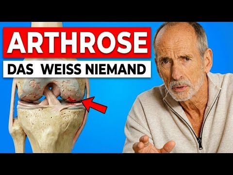 Niemand sagt Dir DAS über ARTHROSE
