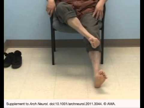 Patient With Spinocerebellar Ataxia Types 2 and 10