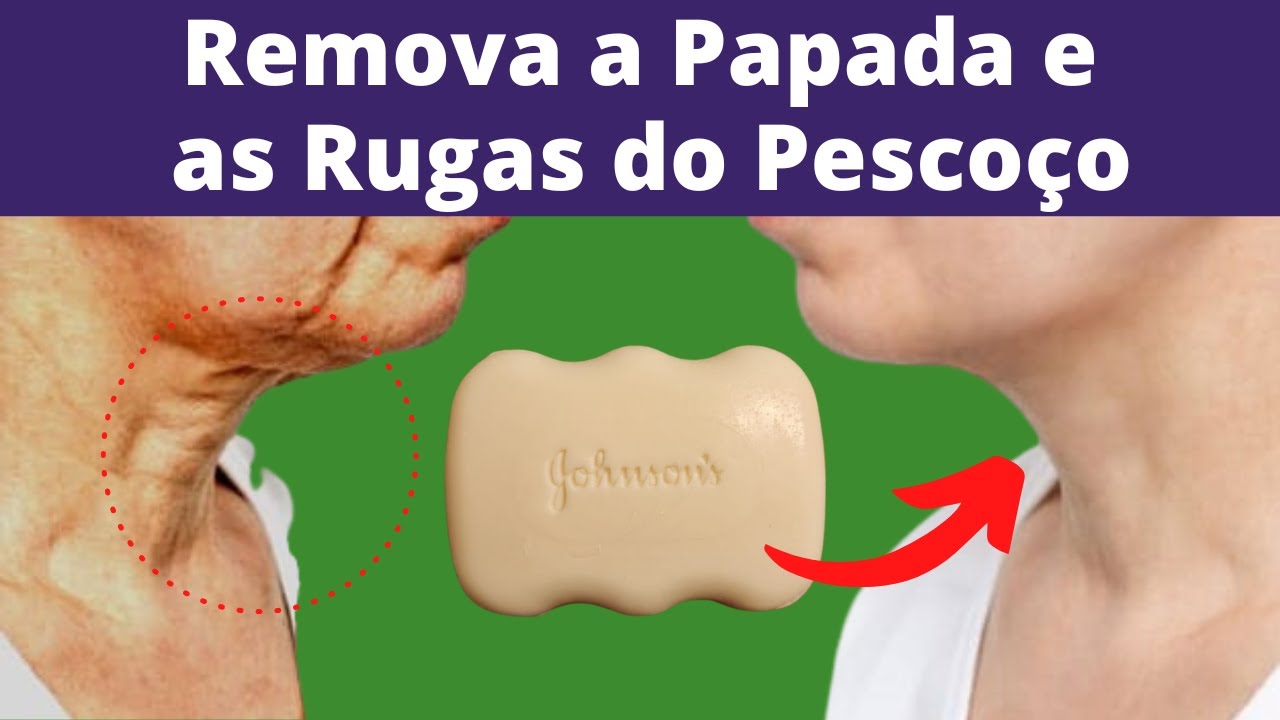 Como Eliminar a Papada, a Flacidez e as Rugas do Pescoço - Fique com o PESCOÇO 10 ANOS MAIS JOVEM