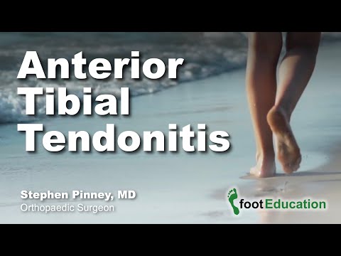 Anterior Tibial Tendonitis