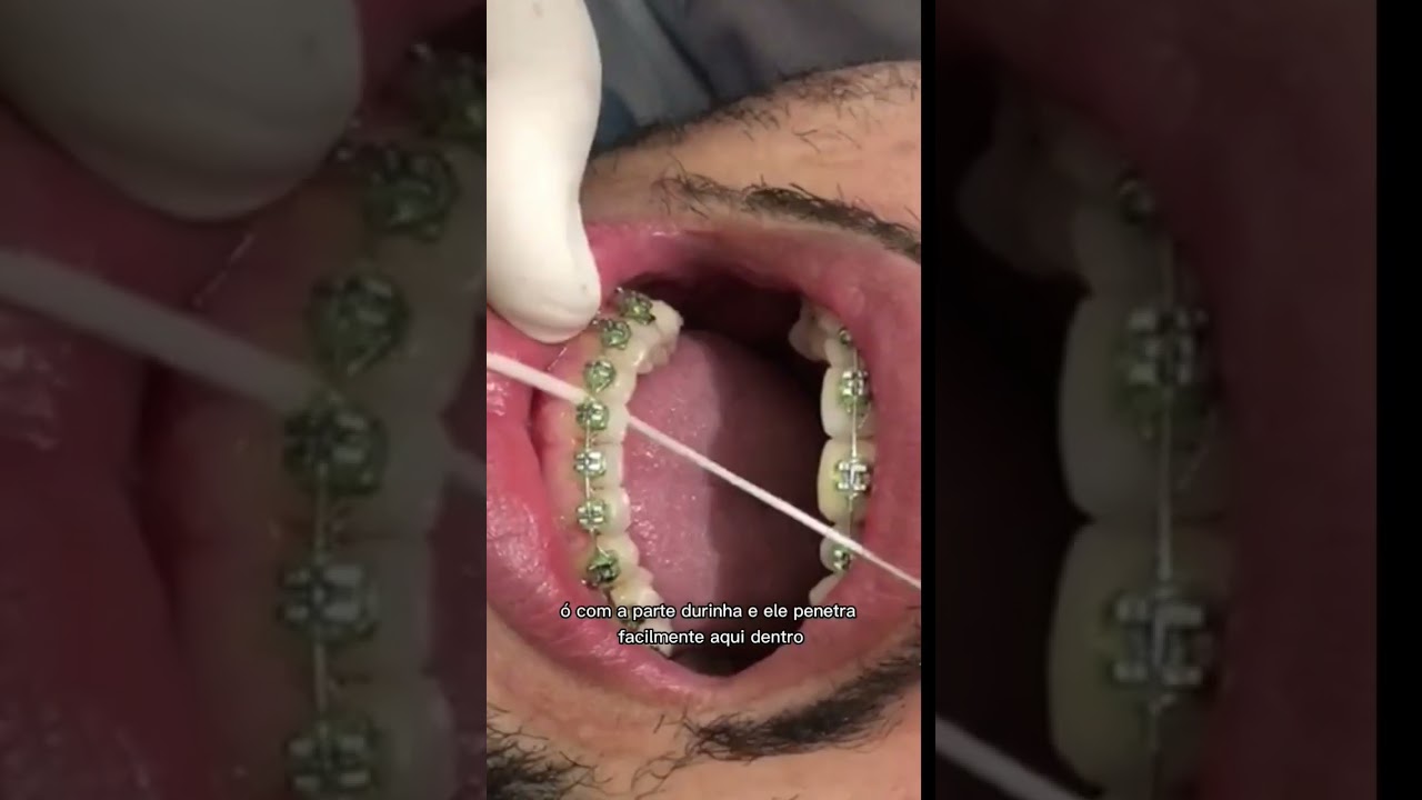 Gislene Isabel De Mendonça-13