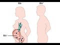 Rh blood type and complications during pregnancy & Fertilization