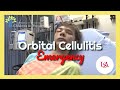 Orbital Cellulitis Emergency