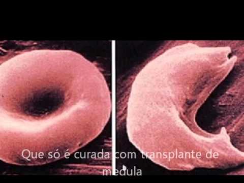 Paródia- Pra você lembrar(do sangue)
