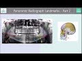 Panoramic Radiograph Landmarks Tutorial - Part 2