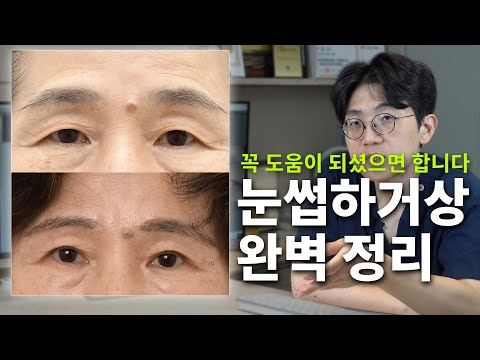 中年眼部 02