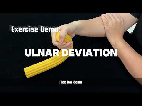 Ulnar Deviation