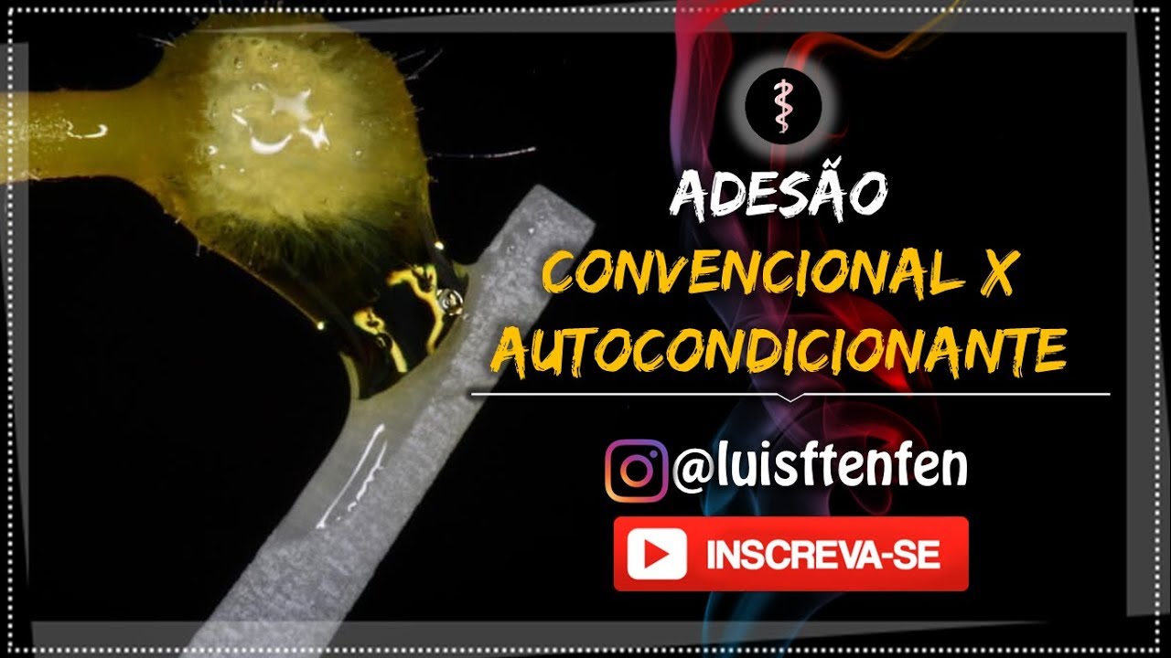 Adesão Convencional x Autocondicionante