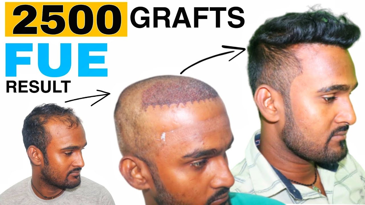 https://www.youtube.com/embed/lNBwi2rIrk4