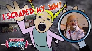 I Scraped My Jaw! | Operation Ouch | Science for Kids