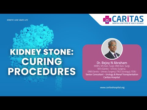 Curing kidney stones: know the caritasian ways