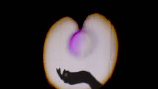Bruise Music Video