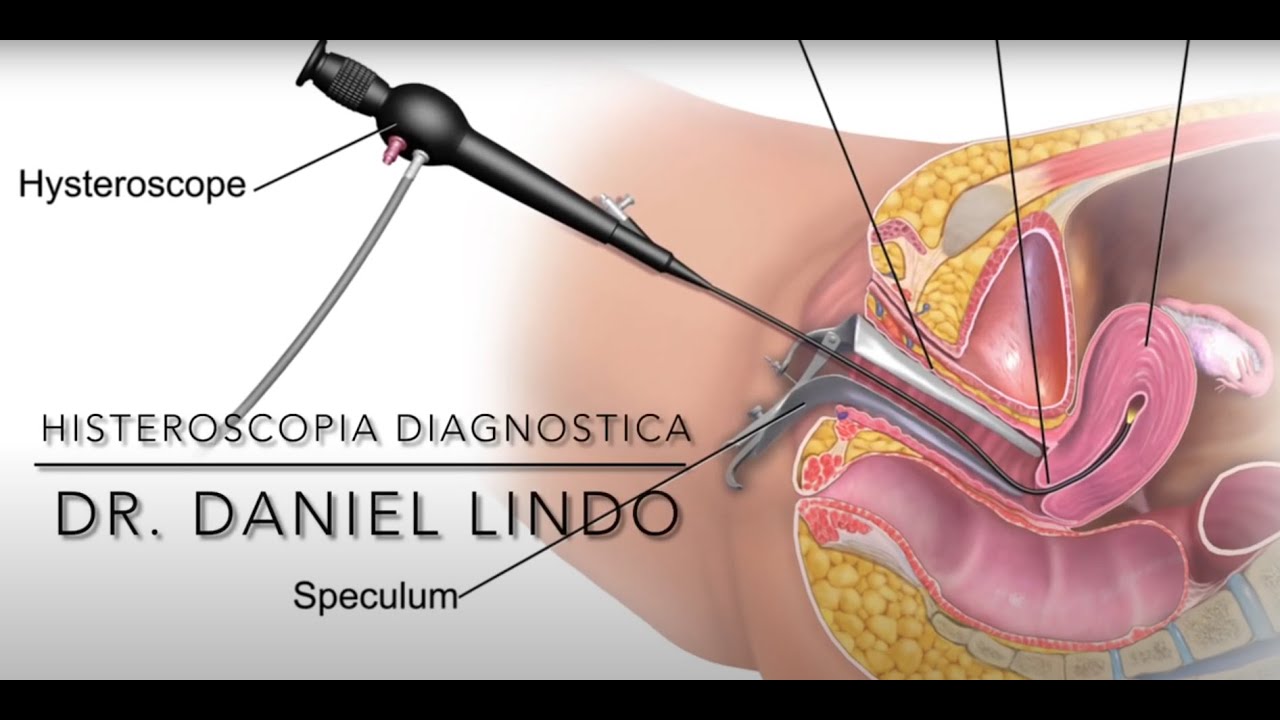 Daniel Paul Lindo Gutarra-26