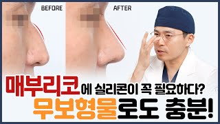 매부리코 교정, 무보형물코성형이 답이다! - 닥터 오승일