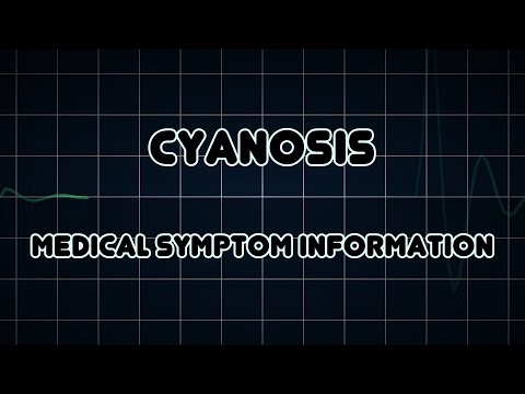Cyanosis (Medical Symptom)