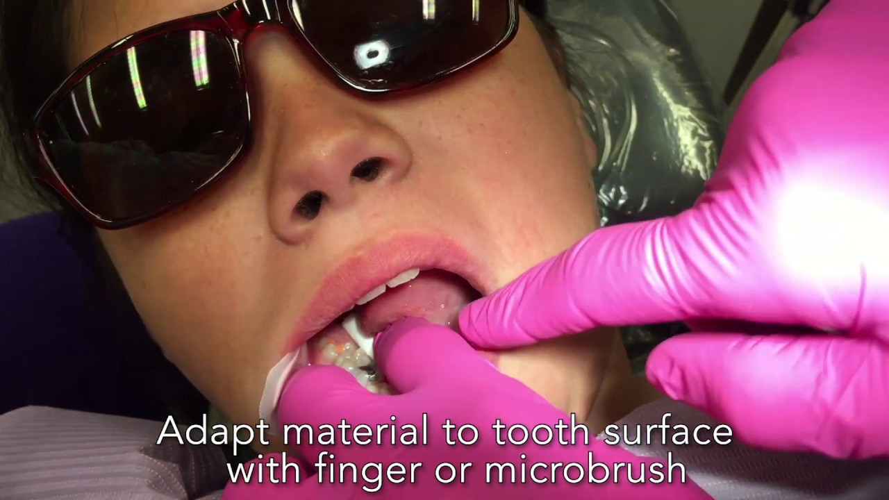 GC Fuji TRIAGE: Une application réalisée par le Dr. Jeanette MacLean