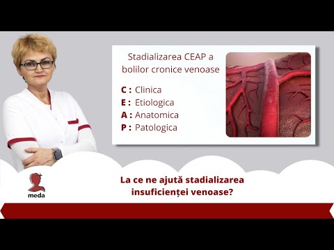 punctie prostata pret prostatita pentru raceli