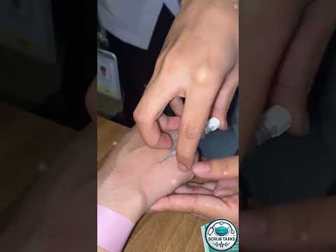 IV Cannula insertion | nursing tips