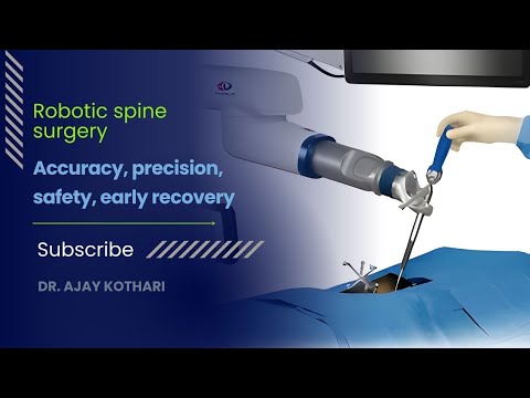Robotic spine surgery : Accuracy ,precision , safety ,early recovery| Dr. Ajay Kothari