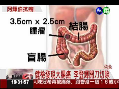 李登輝大腸癌動刀 馬總統探望