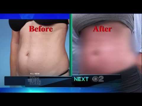 cum să pierzi adipos belly fat