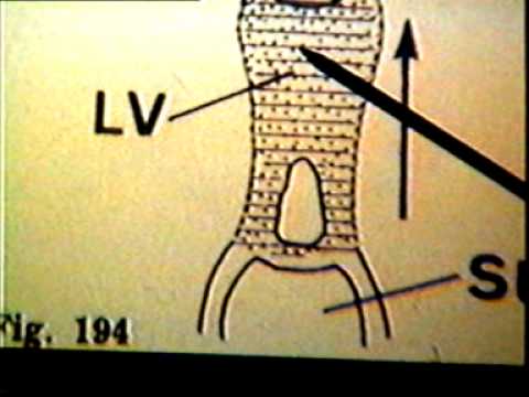 Dr Eduardo Kremenchutzky - Embriología humana -Genitales internos