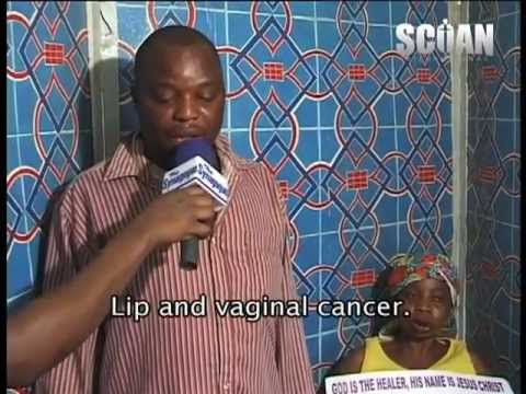 TB Joshua - Healing of Lips Cancer & Vaginal Cancer