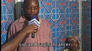 TB Joshua - Healing of Lips Cancer & Vaginal Cancer