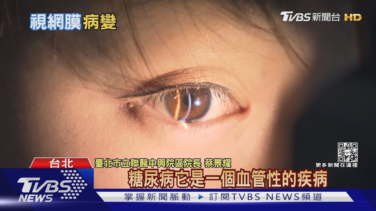 輕忽「這疾病」任由血糖飆高 導致視網膜病變 醫警告 恐「失明」!