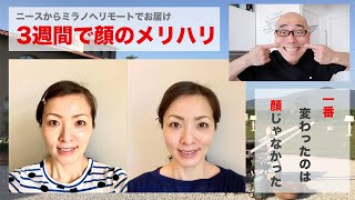 3週間経ったフェイストレの効果はいかに？？ #23【ミラノ】【ニース】