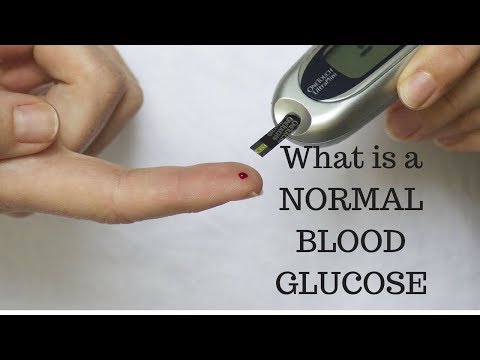 image-What is the normal range of glucose levels? 