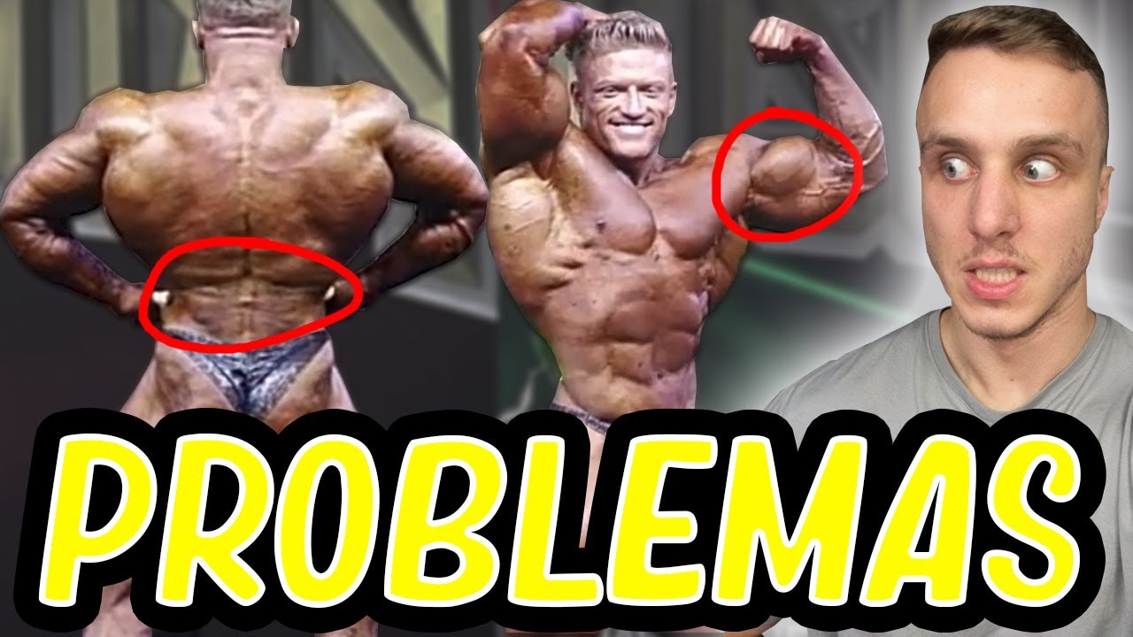 El problema de Urs en la categoría open *deterioro físico*