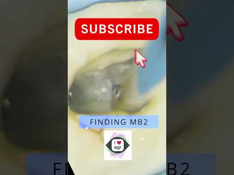 USING ULTRASONIC TO FIND MB2