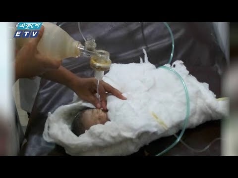 জেগে উঠলো মৃত্যু ঘোষণা করা শিশু মিম