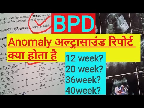 what is BPD in pregnancy ultrasound/week by week measurements
