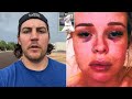 Trevor Bauer Posts Video On YouTube Calling Assault Allegations False