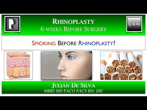 6-Weeks Before Rhinoplasty: Please Stop Smoking