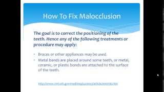 preview picture of video 'Teeth Alignment Problems | How To Fix Malocclusion by Richmond Family Dentist'