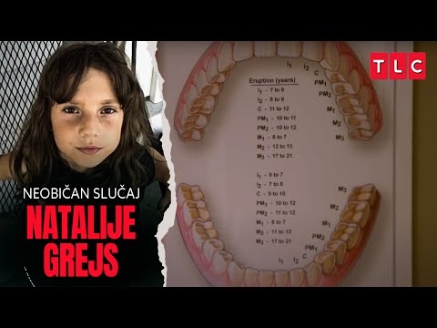 Zubar otkriva njene godine  | Neobičan slučaj Natalije Grejs