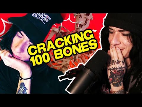 Cracking 100 Bones 3 Years Later